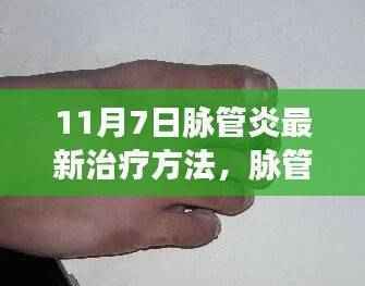 革新疗法引领未来,脉管炎最新治疗突破