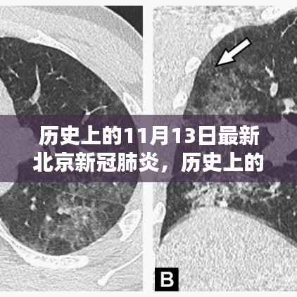历史上的11月13日,北京新冠肺炎最新动态解析与回顾