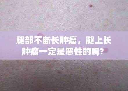 腿部不断长肿瘤,腿上长肿瘤一定是恶性的吗?